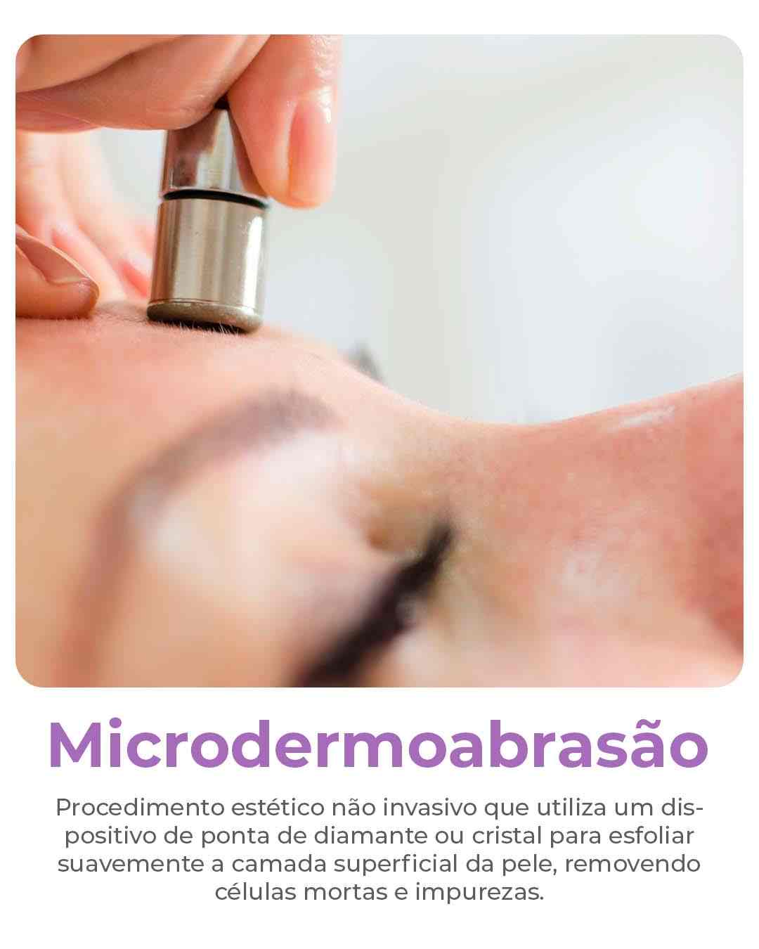 Microdermoabrasao-compressed